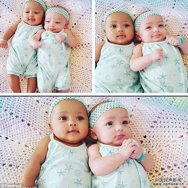 孪生姐妹肤色迥异 没人相信她们是双胞胎